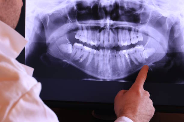Best Chipped Tooth Repair Near Me  in Haines City, FL